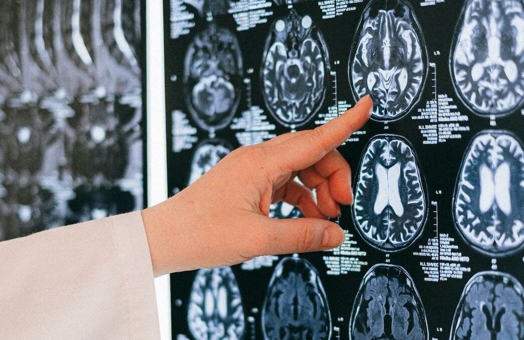 Comment les neurosciences révolutionnent-elles notre vision du développement des jeunes enfants ?